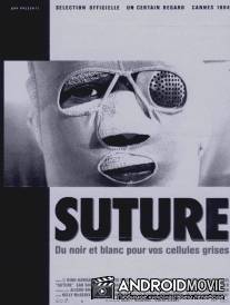 Швы / Suture